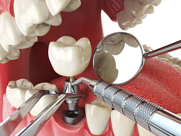 Best Cracked Tooth Emergency Dentist  in Chalfant, CA